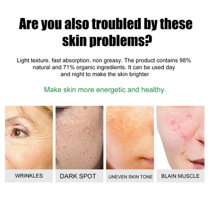 EELHOE Skin Care Cream Improves Dull Skin, Moisturizes Skin, Brightened Skin Care Cream And Clears Acne