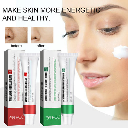 EELHOE Skin Care Cream Improves Dull Skin, Moisturizes Skin, Brightened Skin Care Cream And Clears Acne
