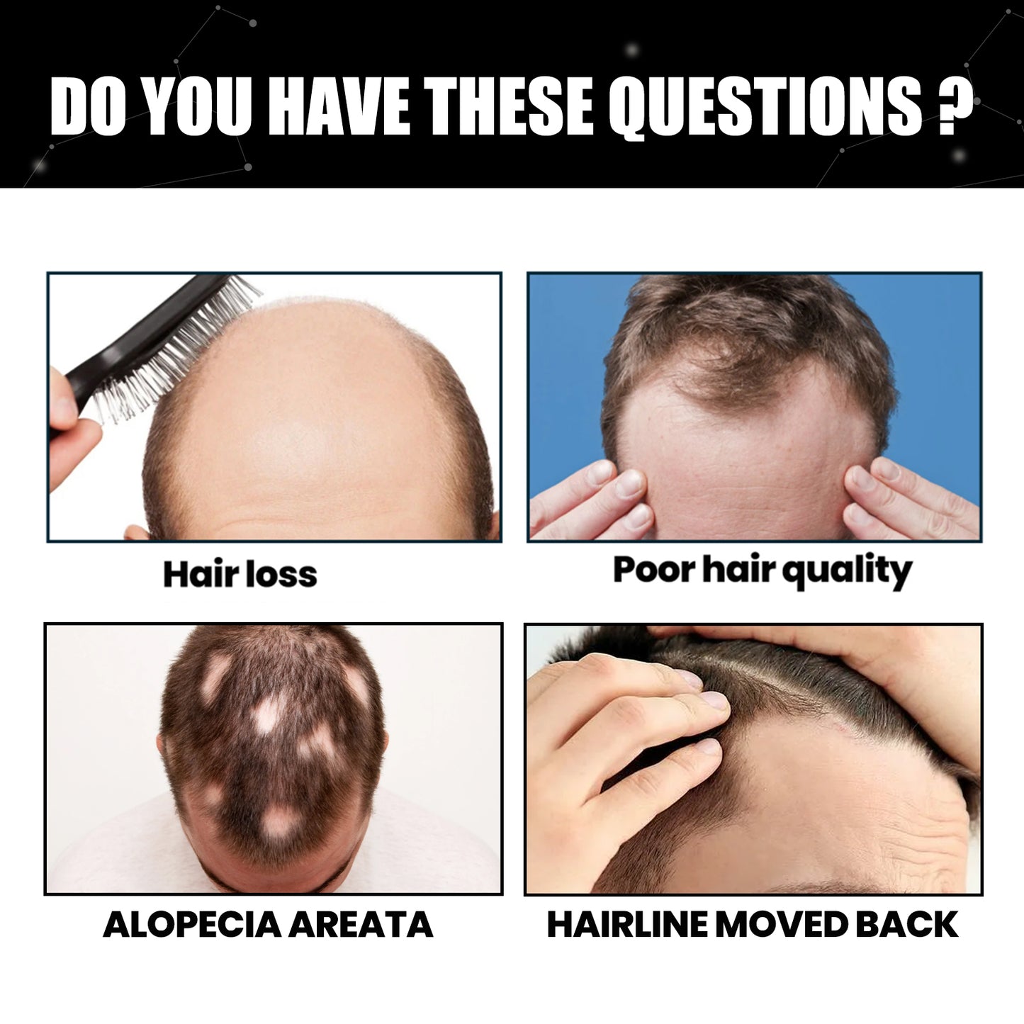 East Moon Hair Thickening Fiber Powder, Multi-Functional Hair Color Filler Hair Seam Hairline Powder