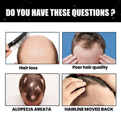 East Moon Hair Thickening Fiber Powder, Multi-Functional Hair Color Filler Hair Seam Hairline Powder