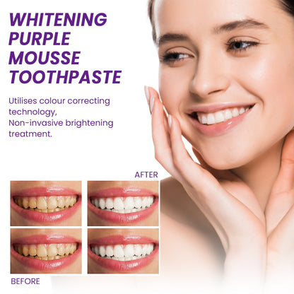 West&Month Purple Mousse Toothpaste Daily Mouthguard Gently Cleans Stains And Tartar Freshen The Mouth
